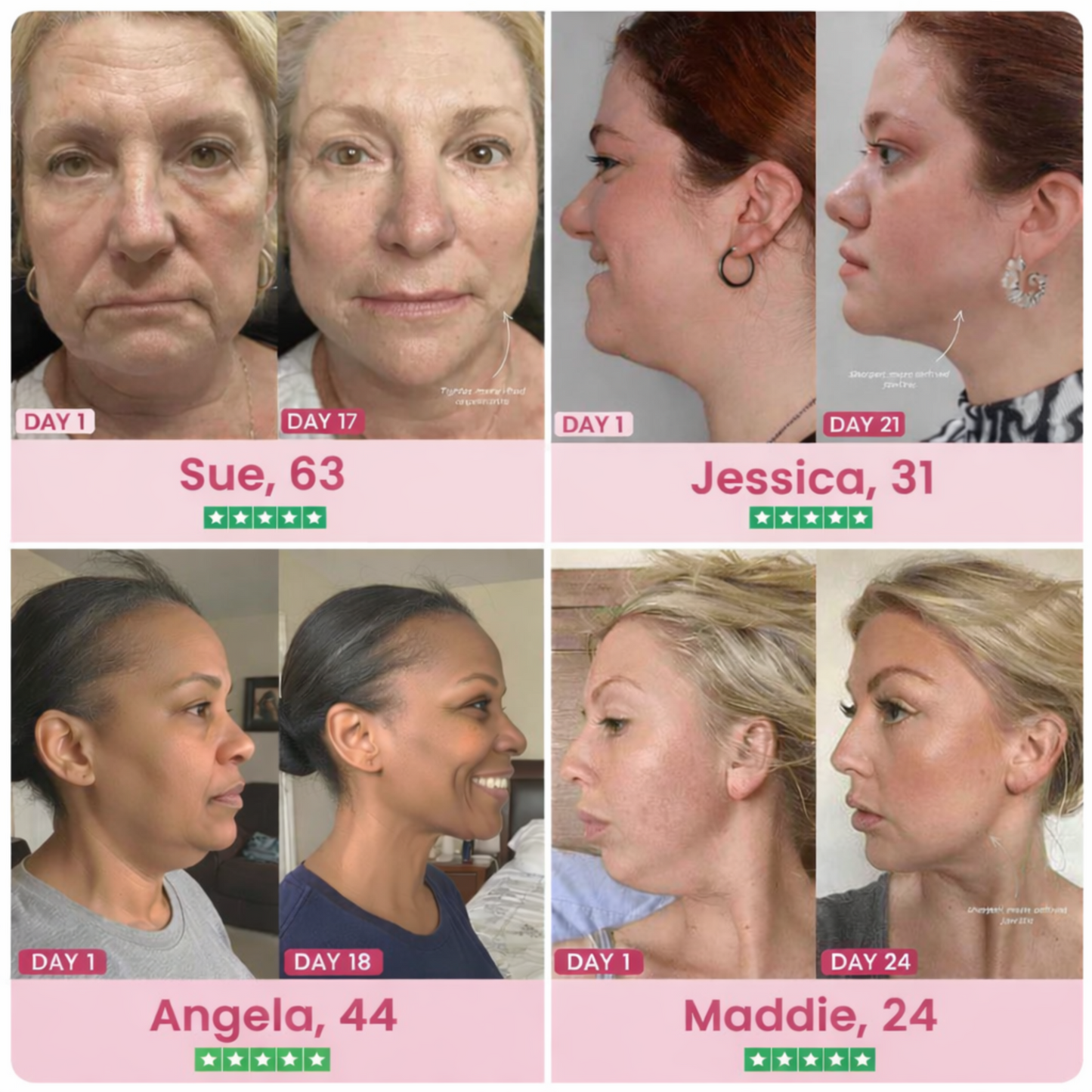 Lumellia Collagen Chin Lifting Gel Mask